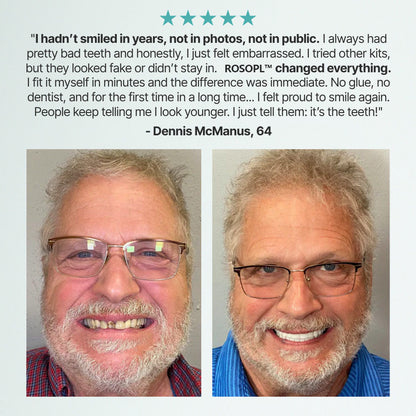 🔥🔥🔥Ends Today: 83% OFF!🦷DarkFairy™ Custom-Fit Full Functional Dentures Make you more confident