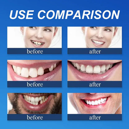 DarkFairy™ Medical Full Denture with Strong Suctiond Custom-Fit Full Functional Dentures🦷