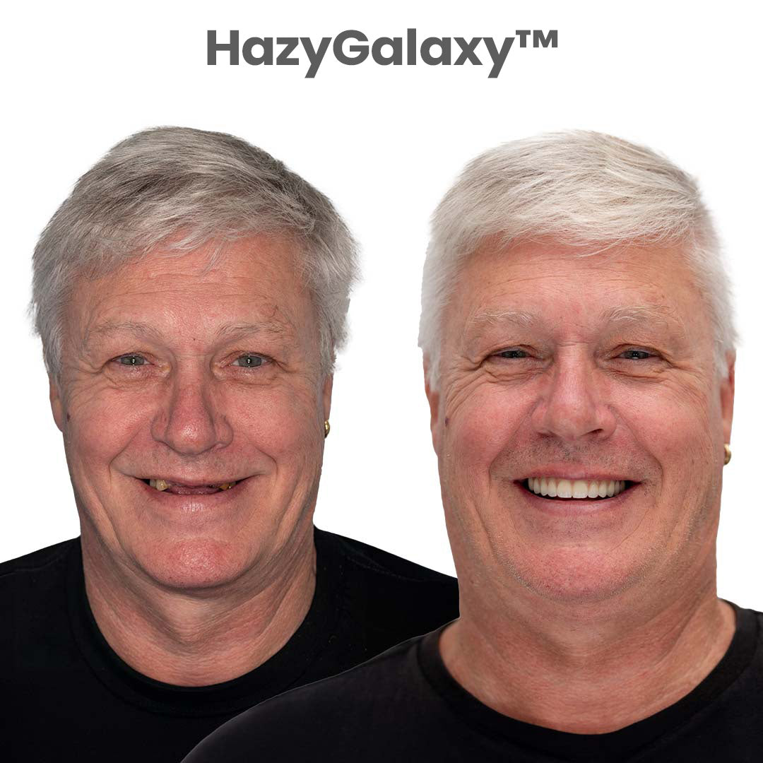 🦷🦷 HazyGalaxy™ Custom-Fit Dentures ⏰ ENDS TODAY   70% OFF | Smile with Confidence