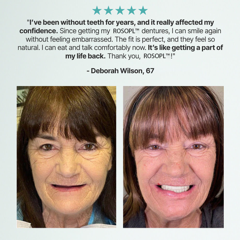 🔥🔥🔥Ends Today: 83% OFF!🦷DarkFairy™ Custom-Fit Full Functional Dentures Make you more confident